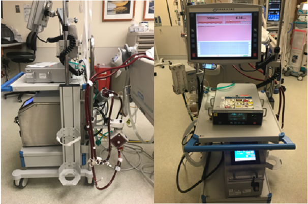 What is ecmo